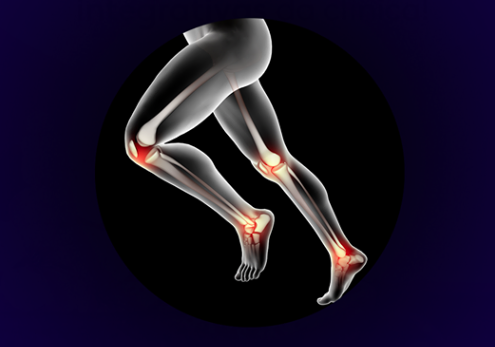 Dr Paulo Casali - Sintomas e tratamento da artrose no joelho