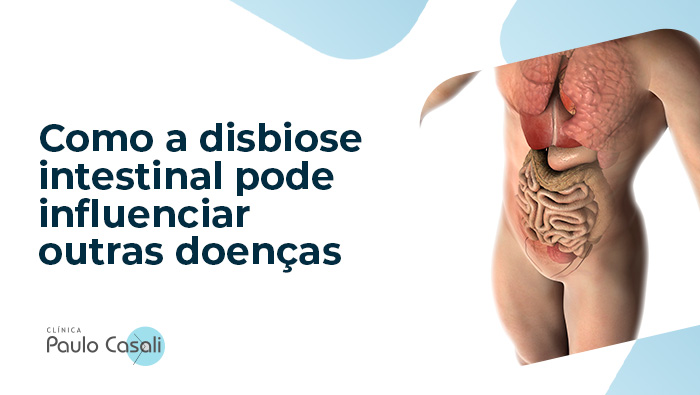 Como a disbiose intestinal pode influenciar outras doencas blog