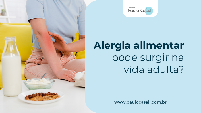 Alergia alimentar pode surgir na vida adulta? 1 Arte sobre alergia alimentar na vida adulta